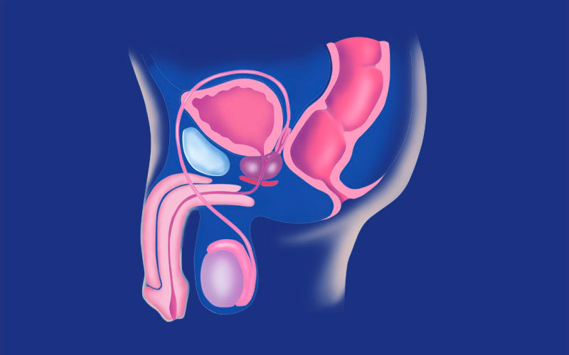 cancer de uretra masculina sintomas
