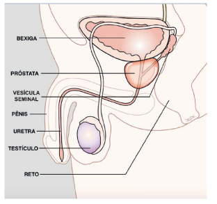 nodul prostata)