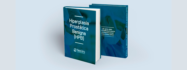 E-book – Hiperplasia Prostática Benigna (HPB)
